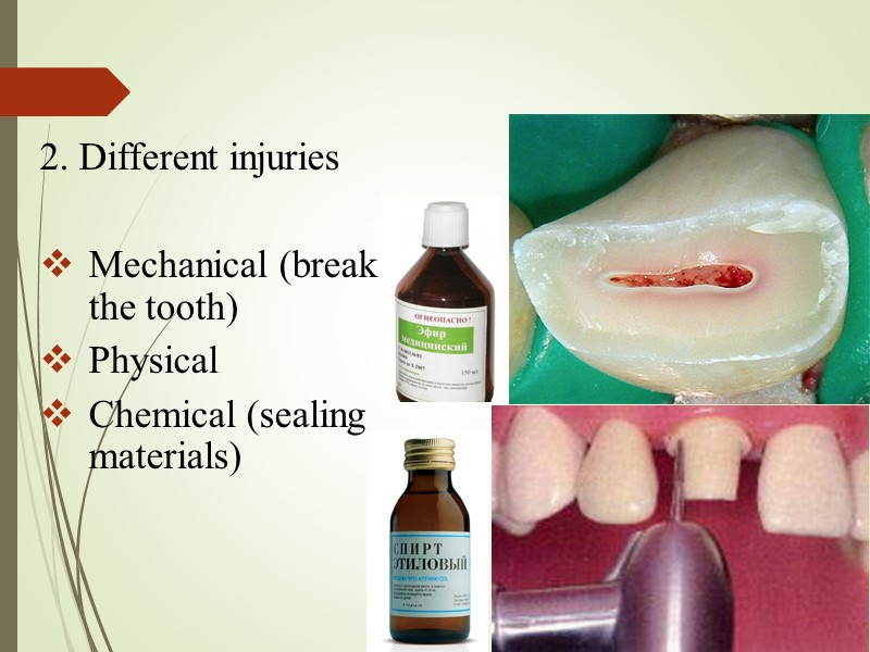 2. Different injuries   Mechanical (break the tooth)  Physical Chemical (sealing materials)